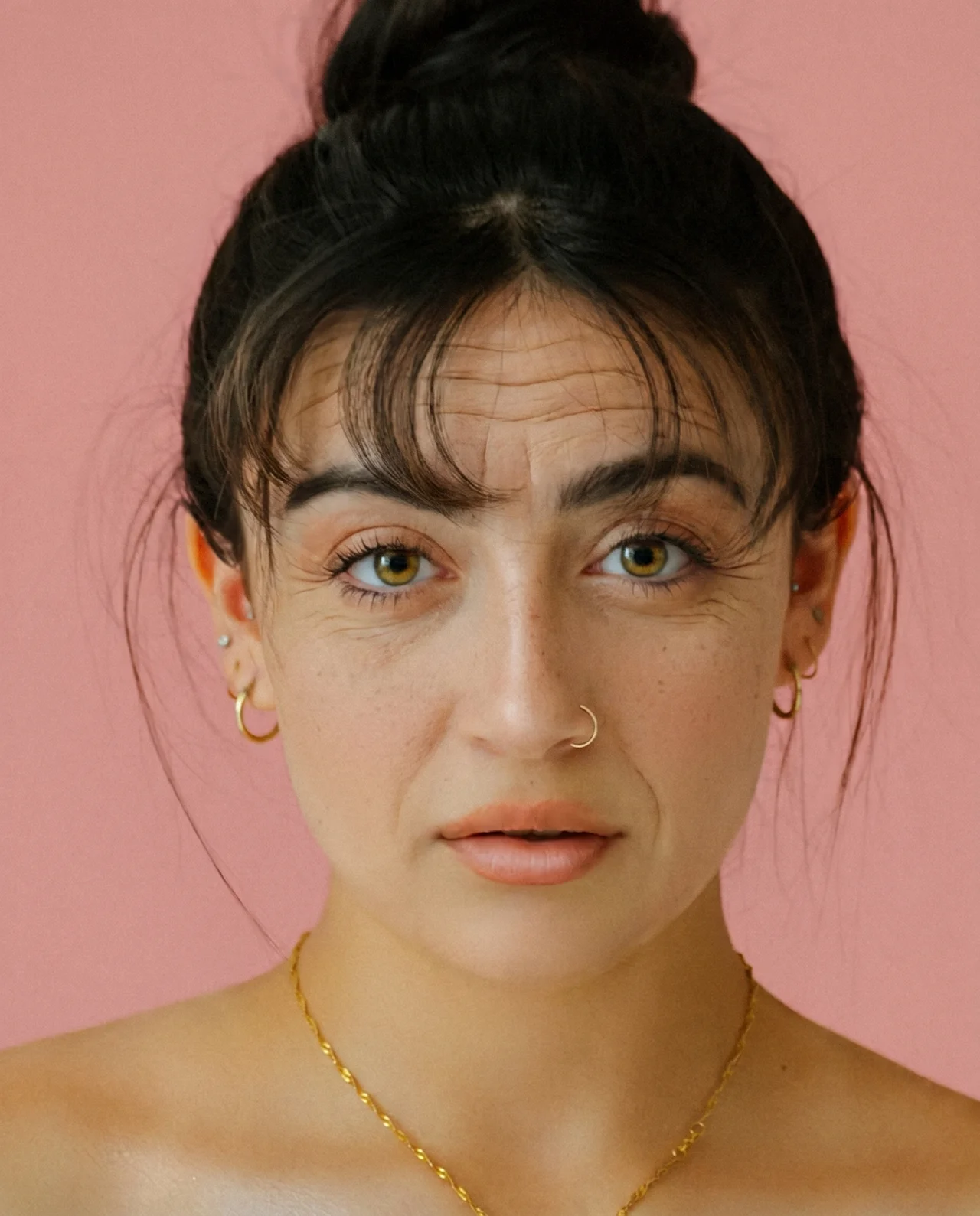 Before Botox treatment